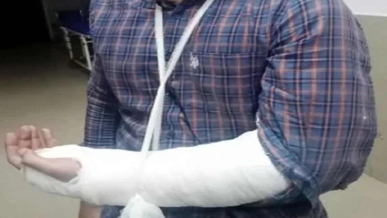 Angry son broke hands of parents by hitting with rod in Gorakhpur