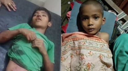 Stray dogs attacked two children in CBganj Bareilly