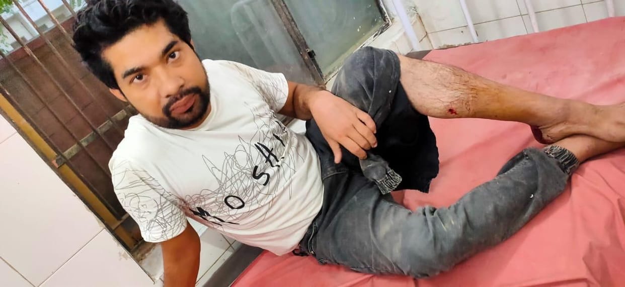 UP Crime: Two Gokash injured and arrested in police encounter in Baghpat