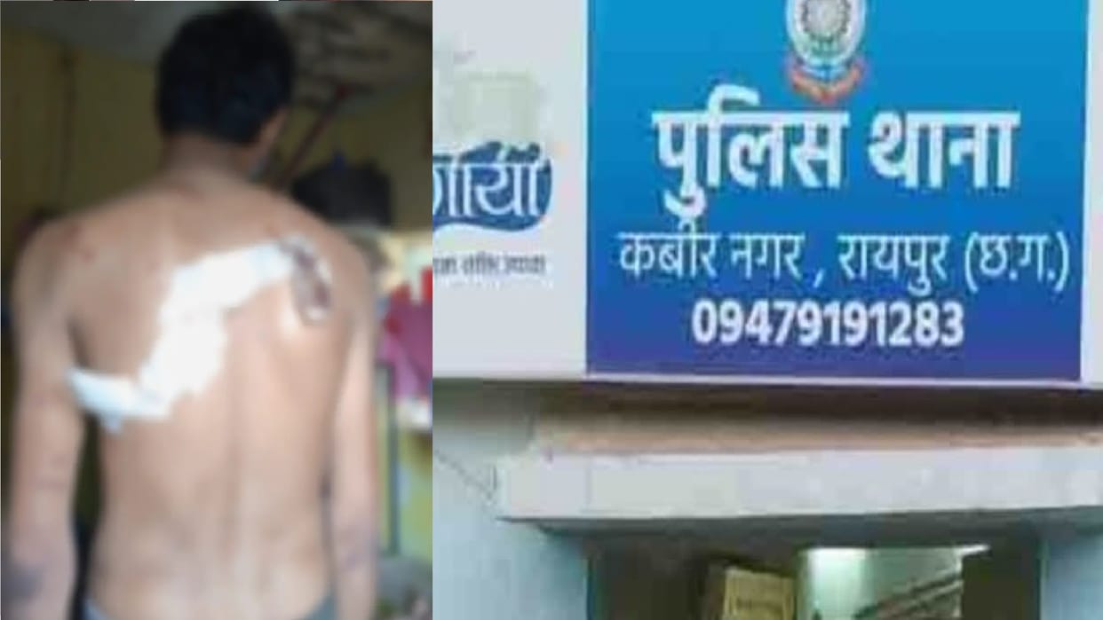 Auto driver attacked with knife, accused absconded from spot in raipur Chhattisgarh