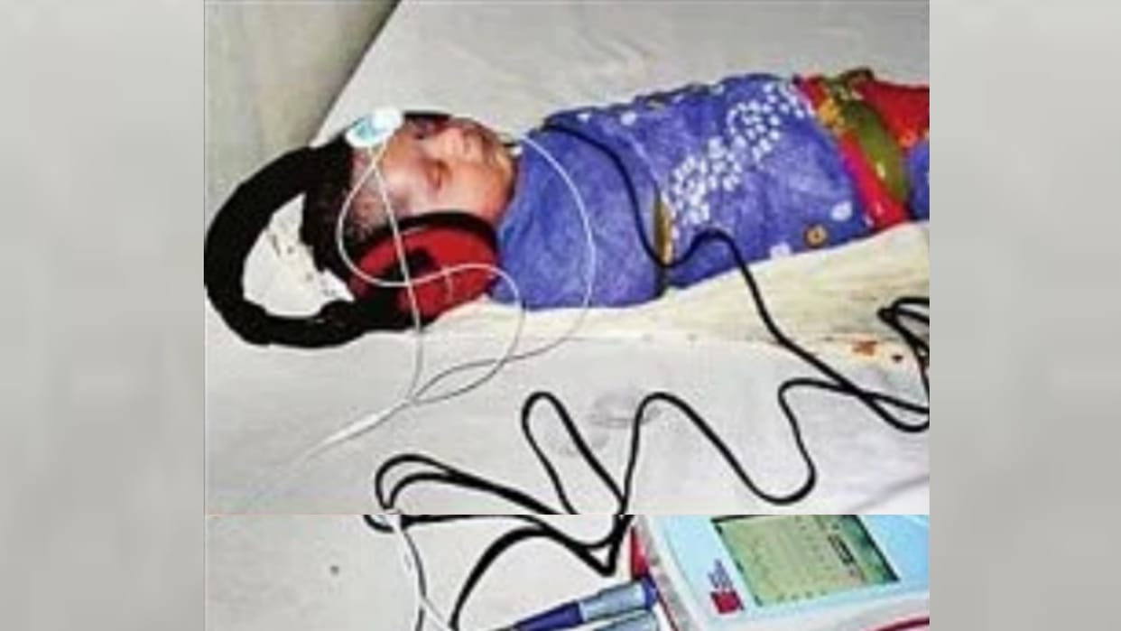 BERA : brain evoked response audiometry checkup in kgmu and lohia institute lucknow