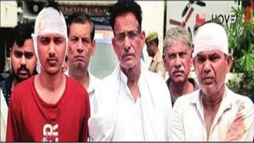 Pitbull bitten the young man, father and son attacked for protest