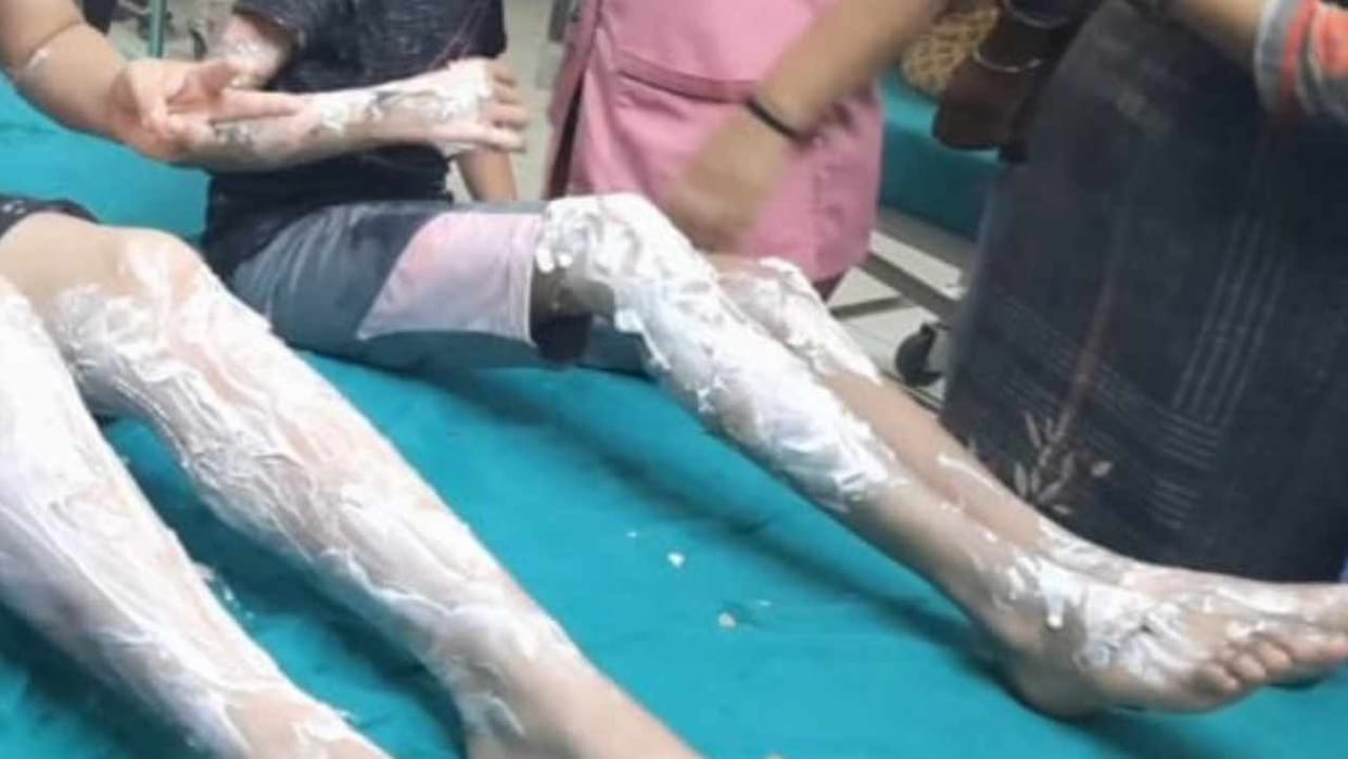 Explosion in house due to leakage in gas cylinder in Nabha
