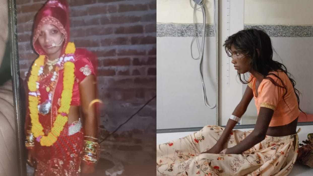 Married woman burnt in Bhilwara Jahajpur