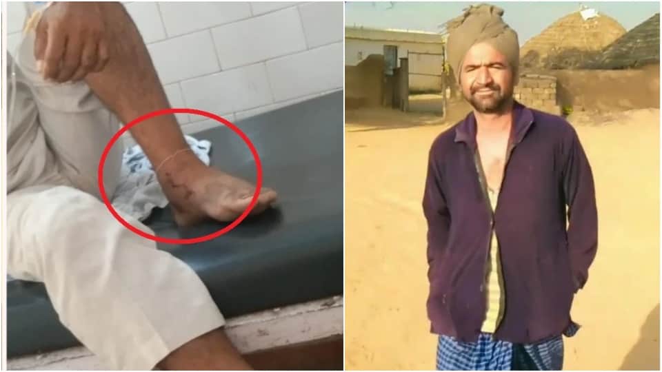 snake bites same person twice in 6 days death in second time Jaisalmer News
