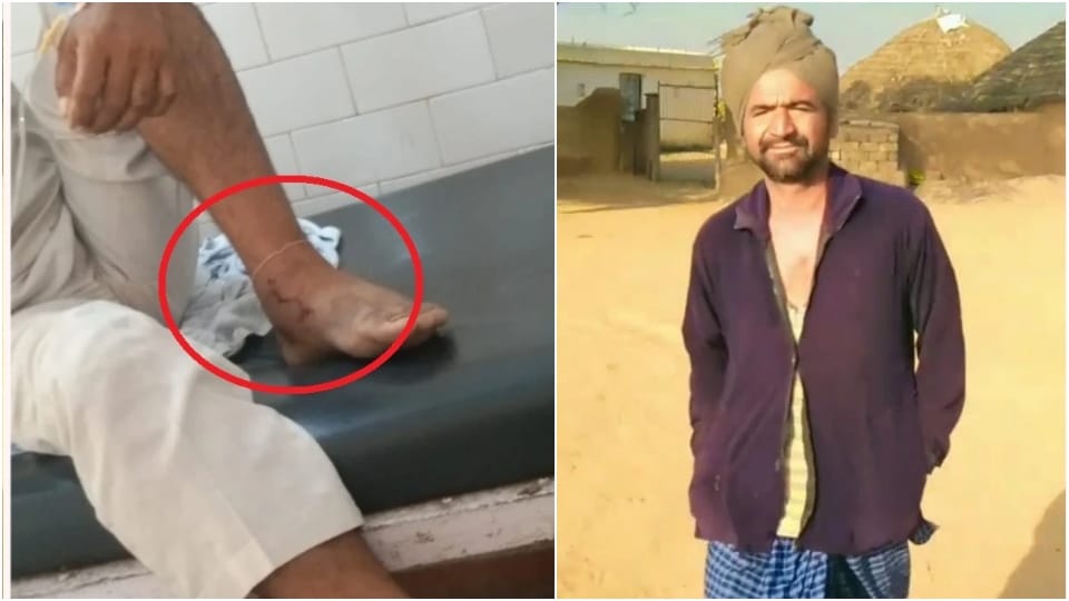 snake bites same person twice in 6 days death in second time Jaisalmer News