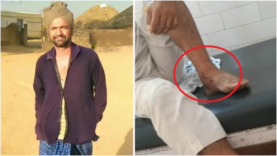 snake bites same person twice in 6 days death in second time Jaisalmer News