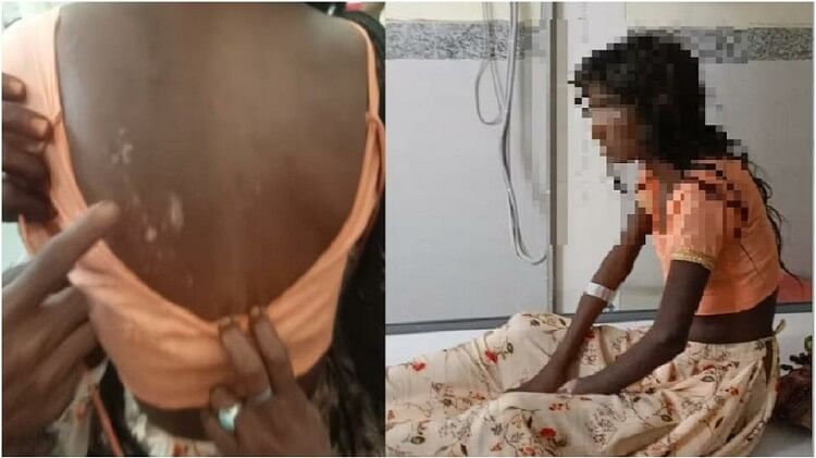Rajasthan: गर्म सलाखों से दागा, पीट-पीटकर दांत तोड़े और फिर इसलिए बुलाई JCB, डायन बताकर बहू के साथ की हैवानियत Bhilwara Crime News: Father In Law Tortured Daughter In Law By Calling Her Witch, Burnt With Hot Rods