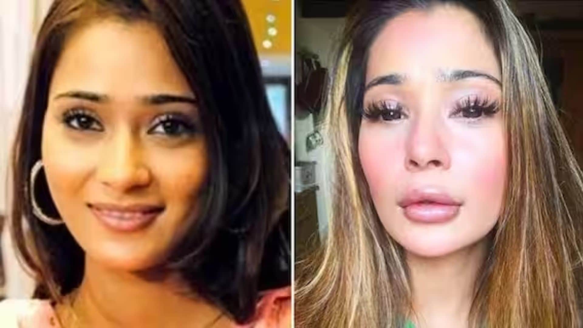 bollywood actresses plastic surgery gone wrong Shruti Haasan Ayesha Takia Sara Khan