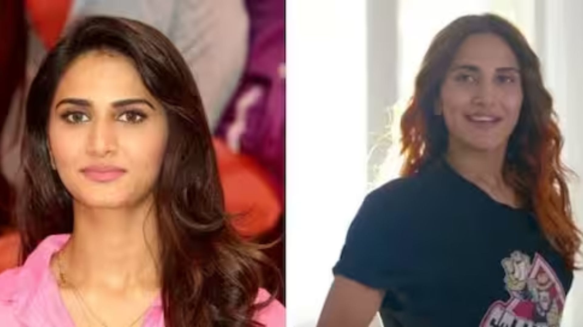 bollywood actresses plastic surgery gone wrong Shruti Haasan Ayesha Takia Sara Khan