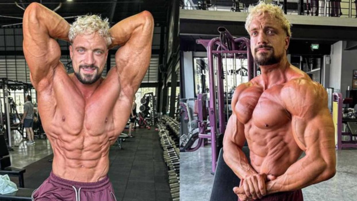German fitness influencer Jo Lindner died from aneurysm, know symptoms and prevention of aneurysm