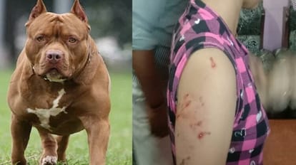 BJP leader pitbull dog attacks 15-year-old girl