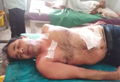 Father stabbed with knives for opposing molestation of daughter in Auraiya, accused of not taking action on po