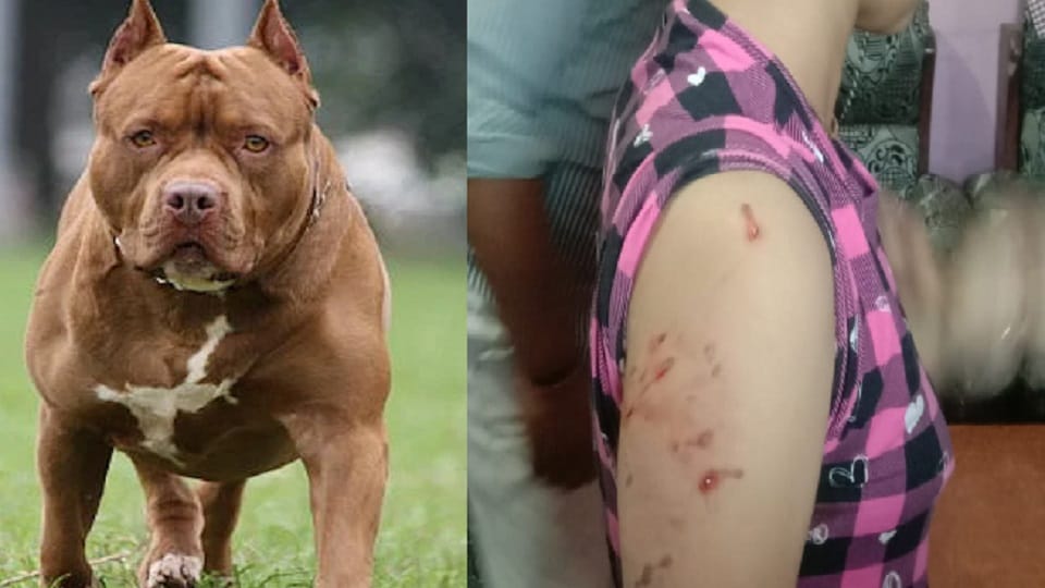 BJP leader pitbull dog attacks 15-year-old girl