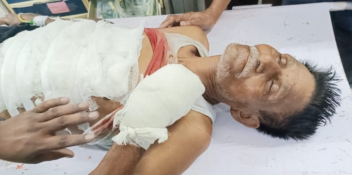 A bullet fired in a childs play dispute, a madman opened fire , old mans paw was blown, hospitalized
