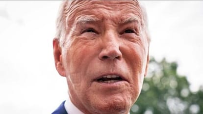Us Republican Congressman Greg Murphy Claim Us President Joe Biden Had Plastic Surgery