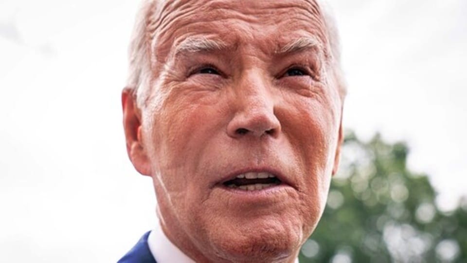 Us Republican Congressman Greg Murphy Claim Us President Joe Biden Had Plastic Surgery