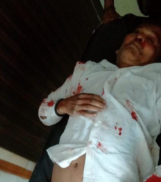 Varanasi Crime: A person from Varanasi was shot in Sarnath, two masked miscreants came on a bike, police on th