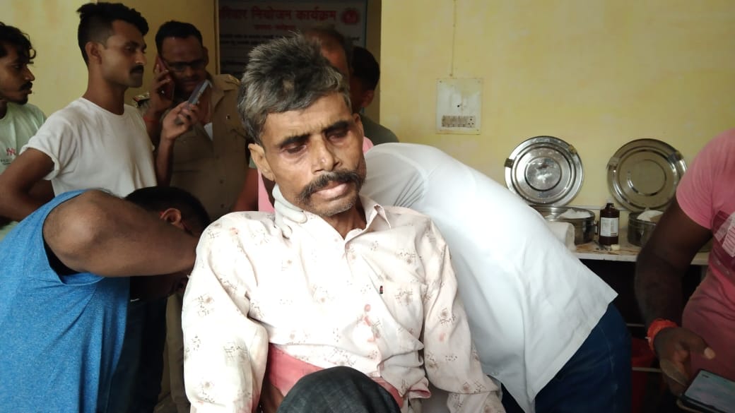 Son died due to fathers bullet in his in laws house, police said he shot himself after reconciliation