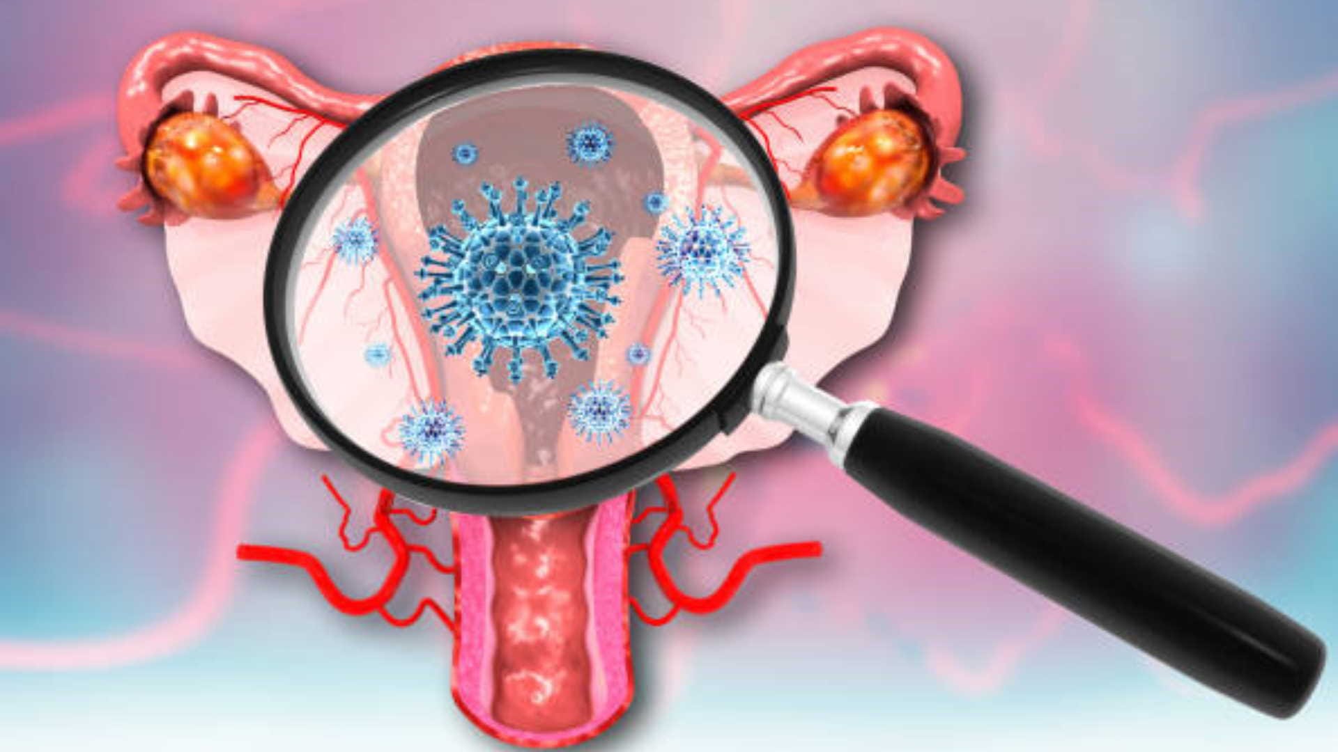 syphilis case highest in 70 years in USA, know its symptoms and causes in hindi