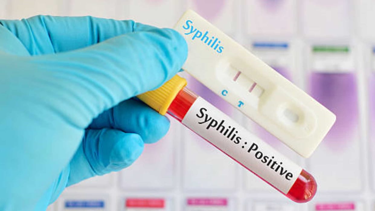 syphilis case highest in 70 years in USA, know its symptoms and causes in hindi