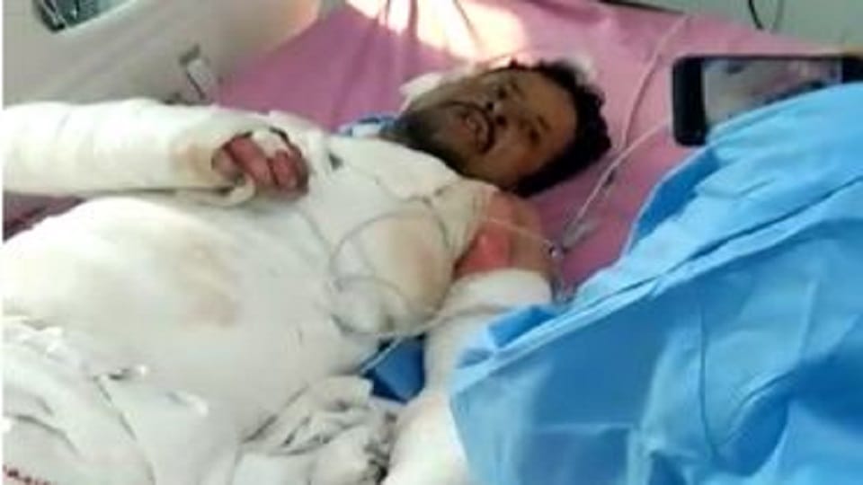 In-laws burnt son-in-law alive by pouring petrol wife also supported in agra up news