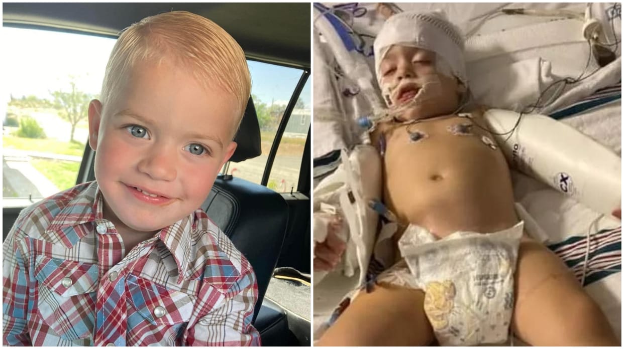 2-Year-Old US Boy Dies Of Brain-Eating Amoeba