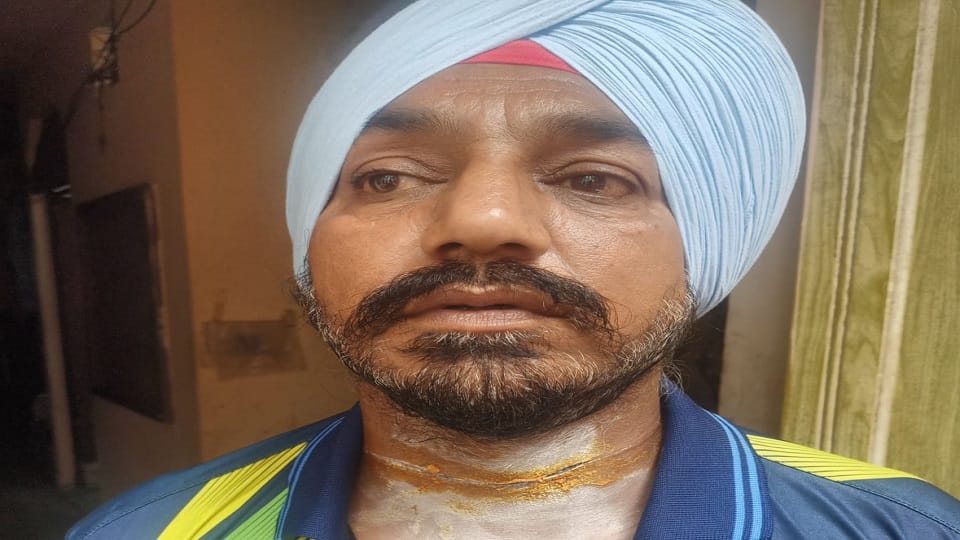 Scooty rider injured after neck cut from Chinese manjha near Yamuna bridge on Vikas Marg