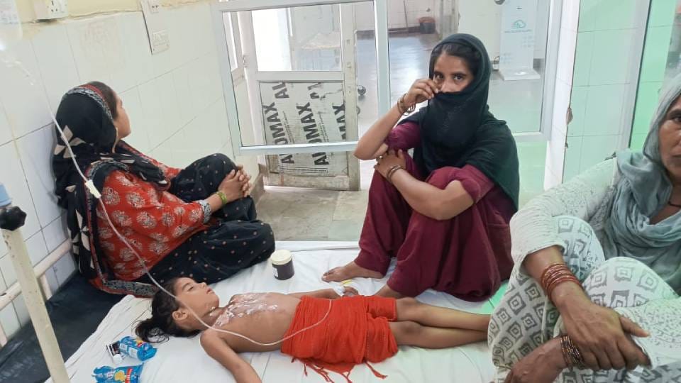 girl got badly burnt when bucket of hot vegetables fell on her While serving food in mid day meal in Mainpuri