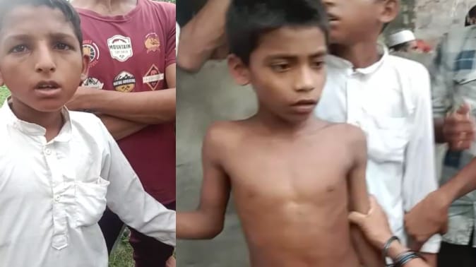 Meerut: Innocent children thrashed on charges of theft in Meerut, one electrocuted, condition critical