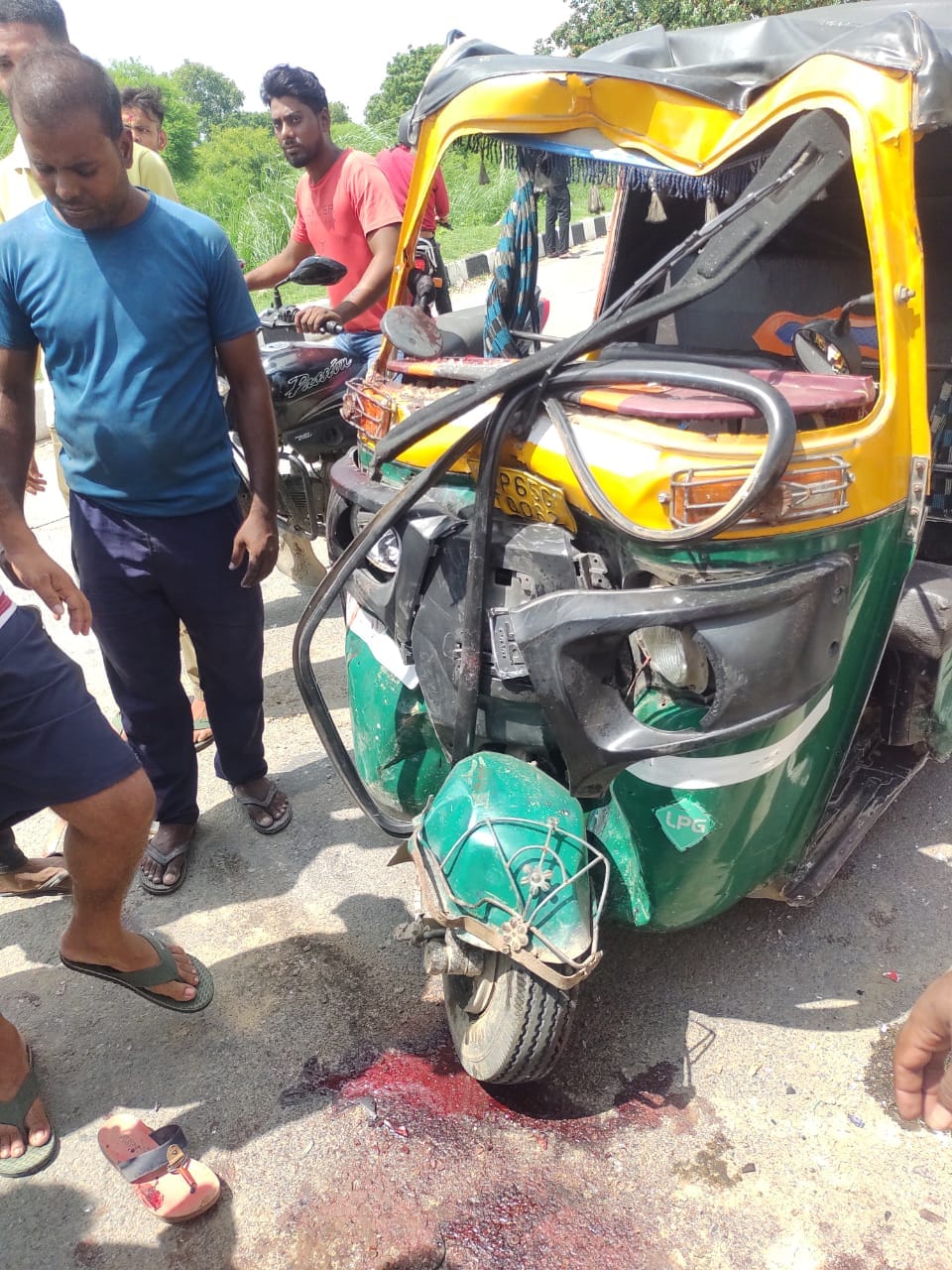 collision between bike and auto rickshaw near Kathy Bridge, seven people injured, admitted to trauma center