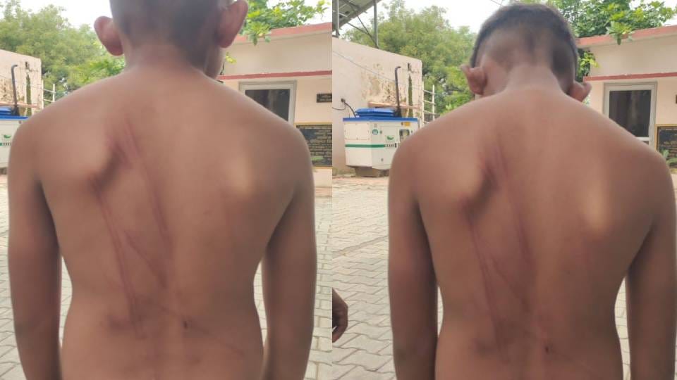 Teacher brutally thrashes child for not doing homework in Agra