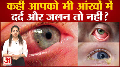 Eye flu continues to wreak havoc, know what are the symptoms and preventive measures