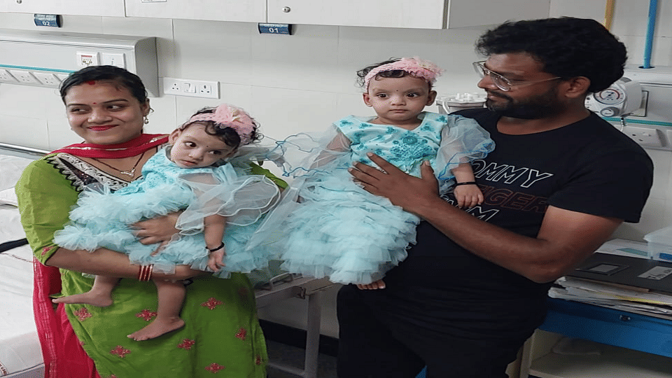 Twin sisters Riddhi and Siddhi were separated after nine hour surgery at Delhi AIIMS