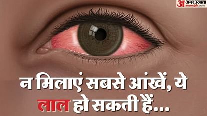 case of eye flu is increasing every day in Lucknow