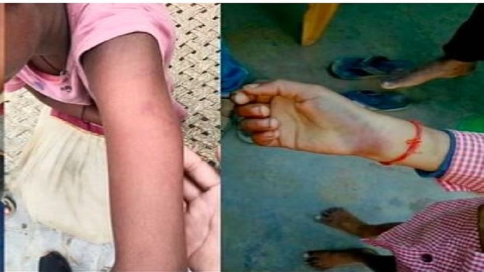 teacher mercilessly beat up girl student In Agra family has filed case against her