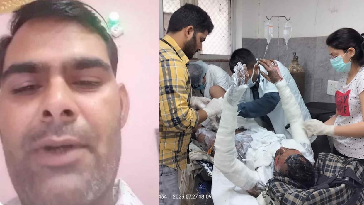 Youth attempted self-immolation in front of Ajmer Kekdi police station