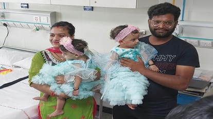 AIIMS doctors separate twin sisters after surgery