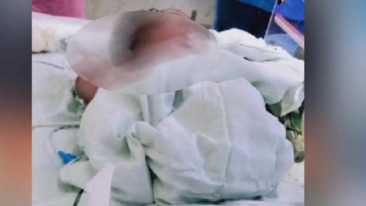 A new born baby slipped from nurse's hand and died.