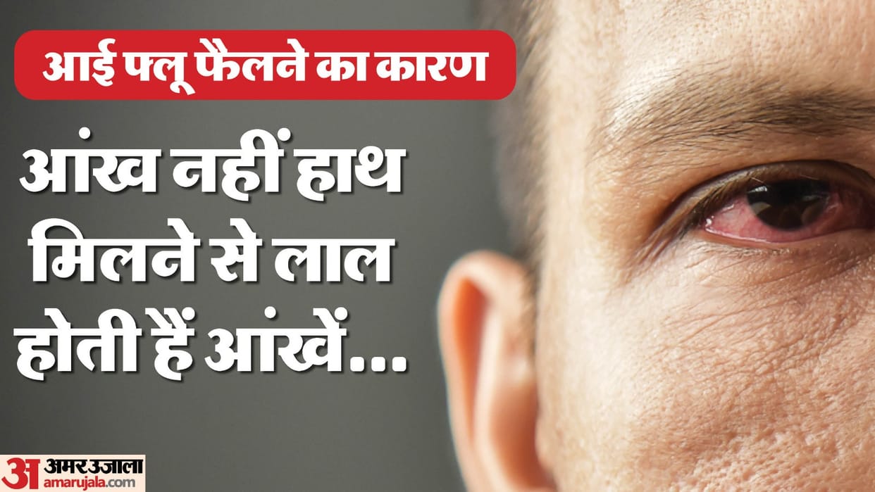 Eye flu is spreading rapidly in Varanasi, know the reason and how to prevent?