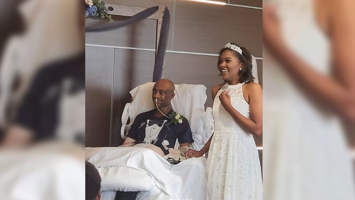 Bride Groom:  groom body burn before marriage bride married after coming to the hospital
