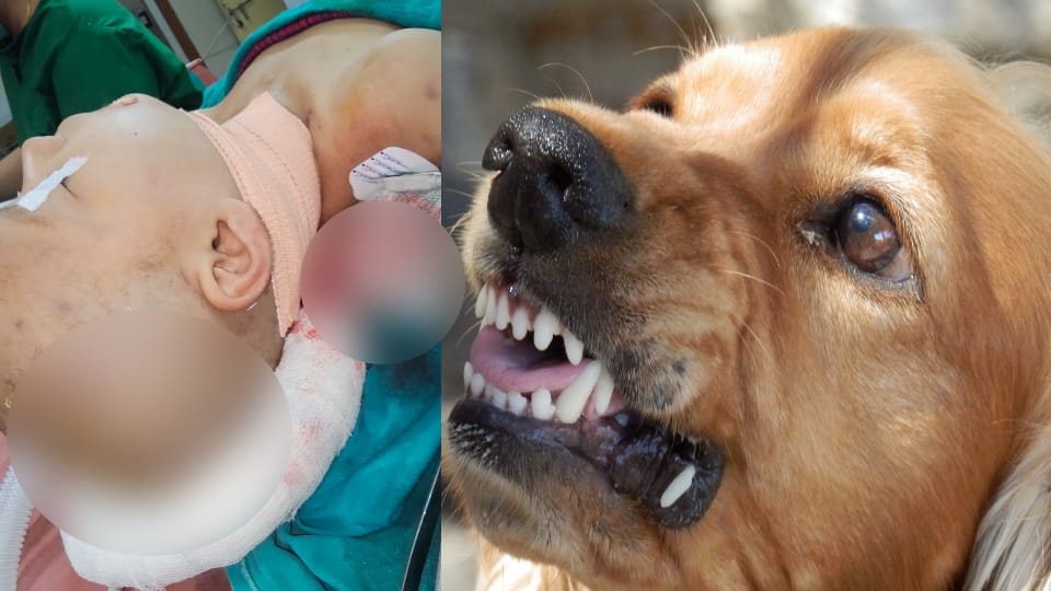 Uttarakhand News Group of dogs attacked a five year old girl going to school in Pauri