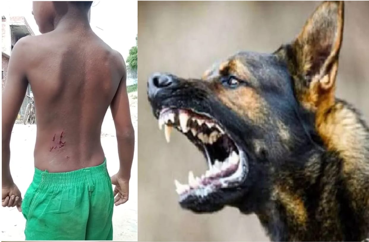 Pet dog scratched a child in Kanpur, Attacked while roaming outside the house, has made many more people victi