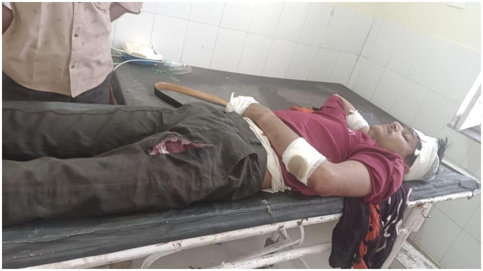 Dalit badly beaten for refusing to make puncture in cbroke hands and legs case registered