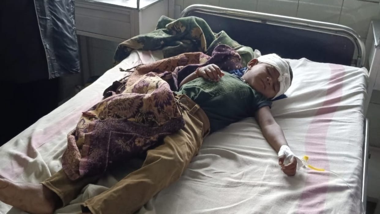 Umaria News Leopard took away the child playing in the house by pressing it in the mouth