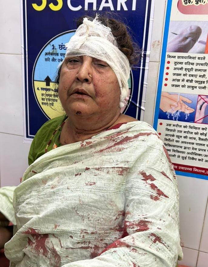 Varanasi Crime News: In Bagbariyar, two groups fought late night, accused of injuring the old woman by firing