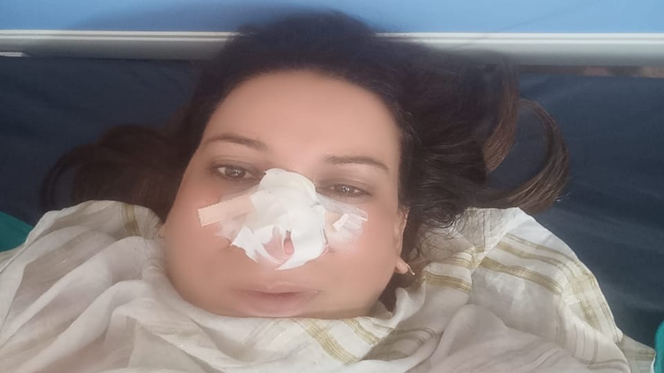 Jammu Injured nurse undergoes nose surgery at SMGS Hospital