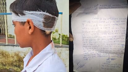 Chhatarpur: The teacher threw the duster and hit the student's head