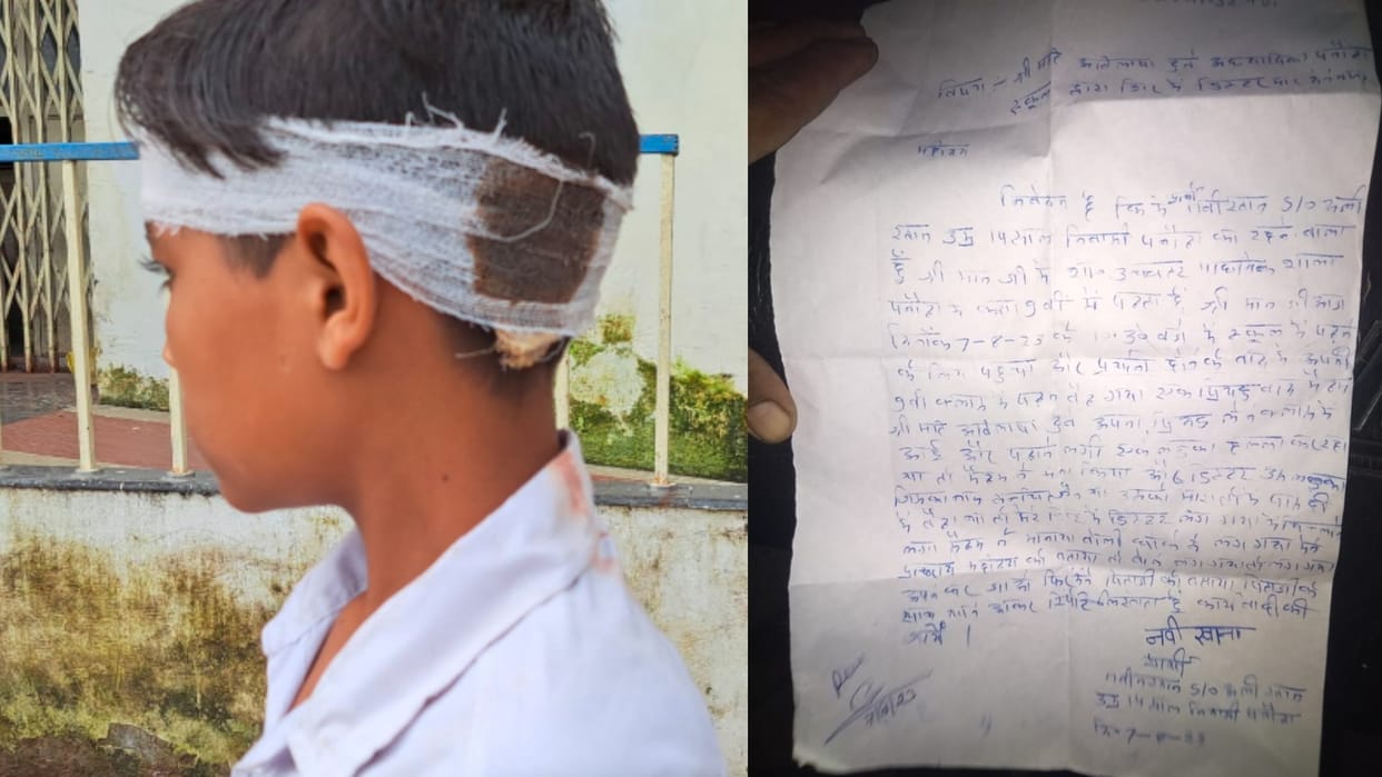 Chhatarpur: The teacher threw the duster and hit the student's head