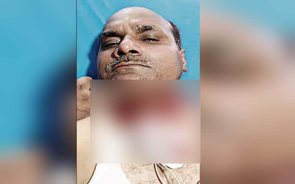 Chinese Manjha slits ASI neck when he was returning home from duty in Meerut, got 74 stitches